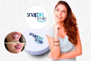 Snap On Smile Recenzie – Stojí to za to? Cena 2024